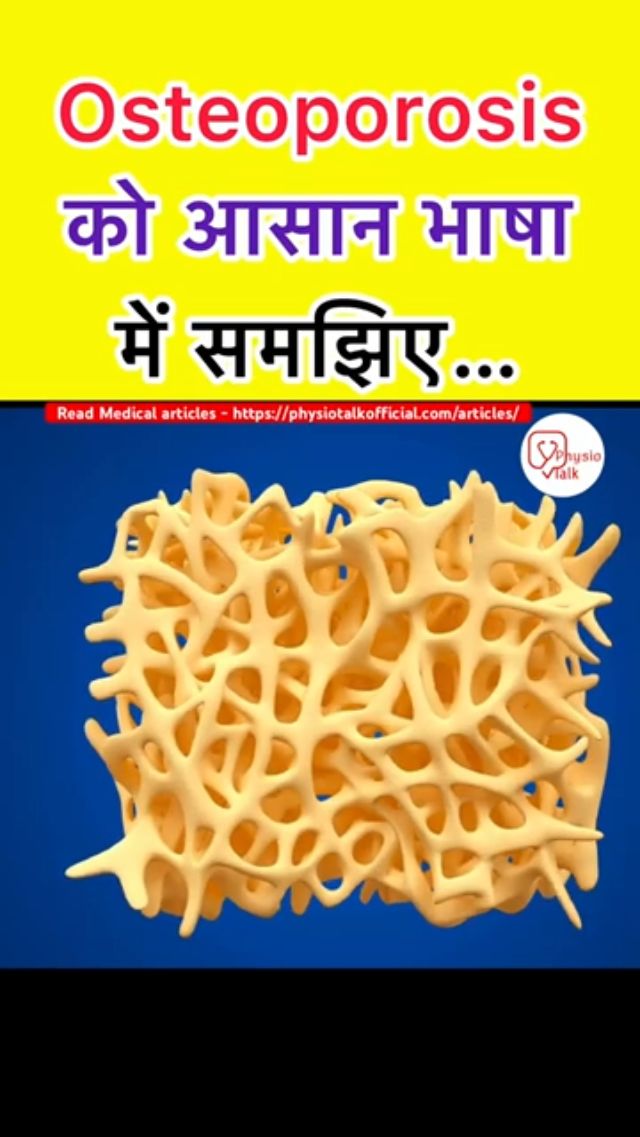 Osteoporosis: Risk Factors, DEXA Scan Interpretation & Best Drug Therapy 2025