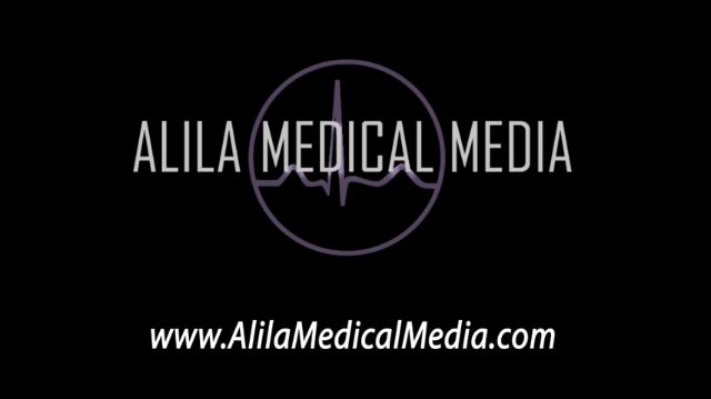 Rheumatoid Arthritis: Clinical Features, ACR/EULAR Criteria & Treatment Options