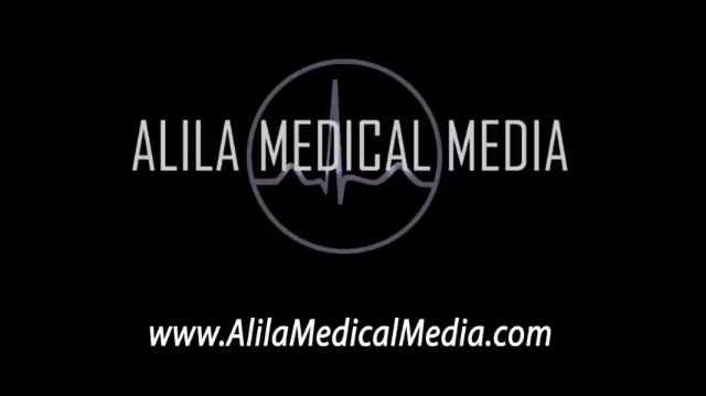 Thyroid Disorders: Hyperthyroidism vs Hypothyroidism With Lab Patterns & Management